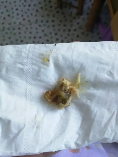 小的没有分节,大的感觉是几个小的串在一起的样子.