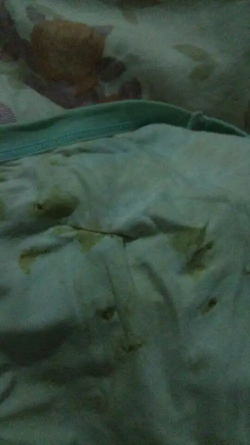 虚岁8岁,小男孩,内裤上有黄色遗留物,怎么回事