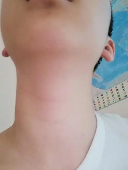 男生喉结长成这样正常吗