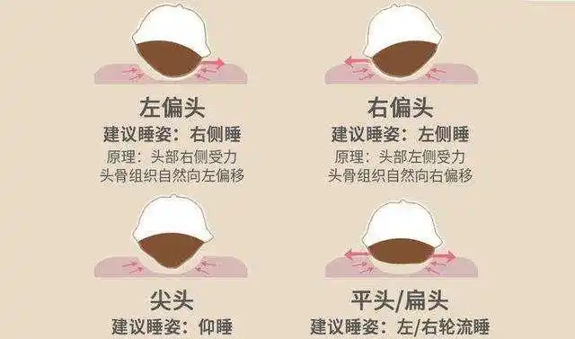 婴儿侧睡和平躺哪个对头型更好?正确的方法遵循两个原则不看睡姿