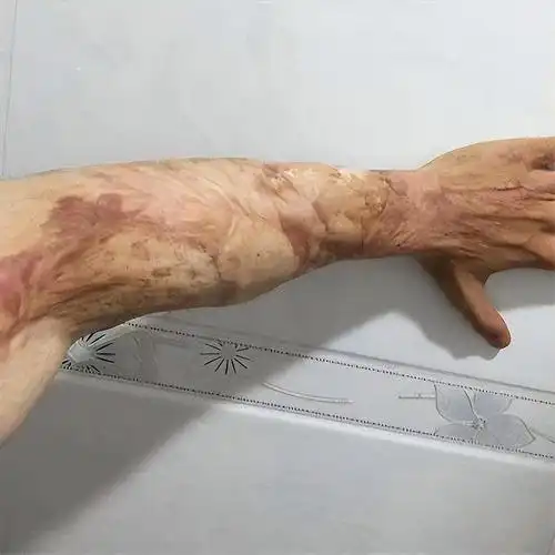 满臂枪伤的老太太