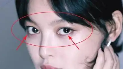 眼睛看命运,拥有这种眼睛的人为"龙眼",一生财运事业运非常好