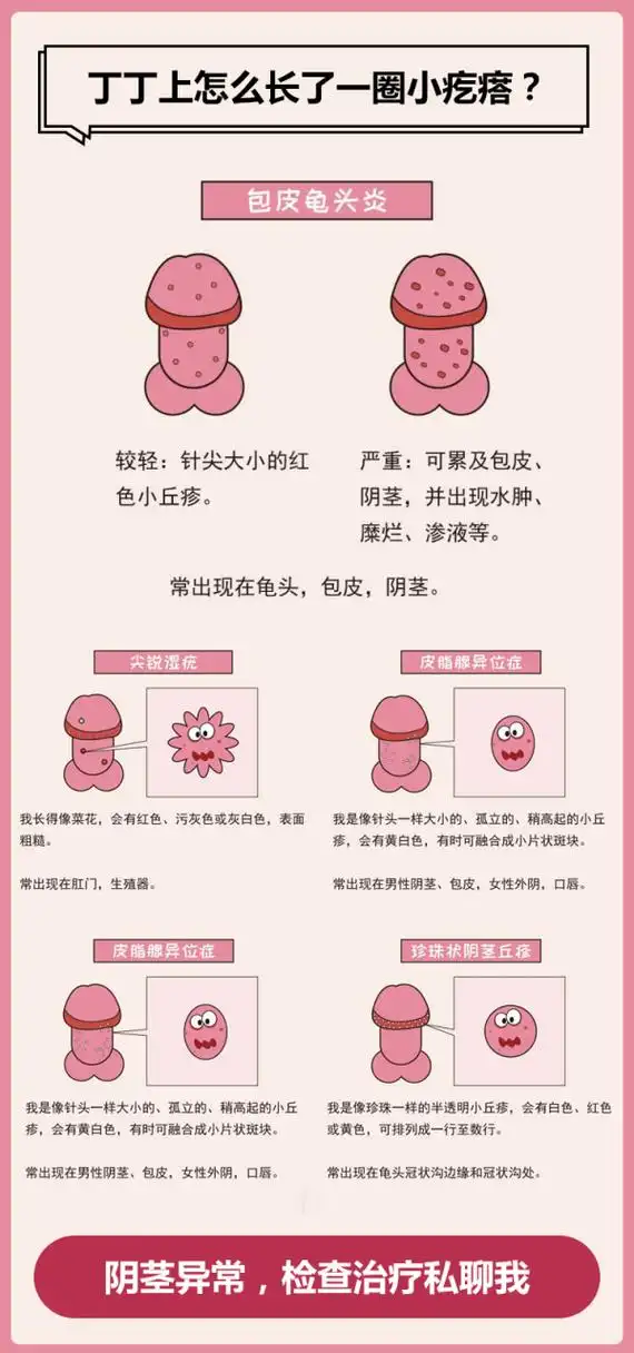 包皮龟头炎#  #泰州东方医院# #泰州东方男科检查58元# #泰州专业