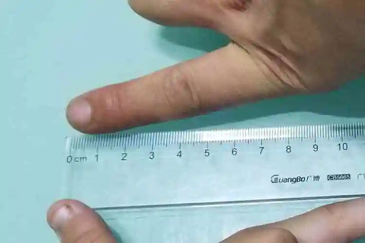 20公分等于多少cm