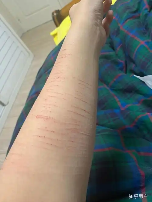 自残属于什么心理