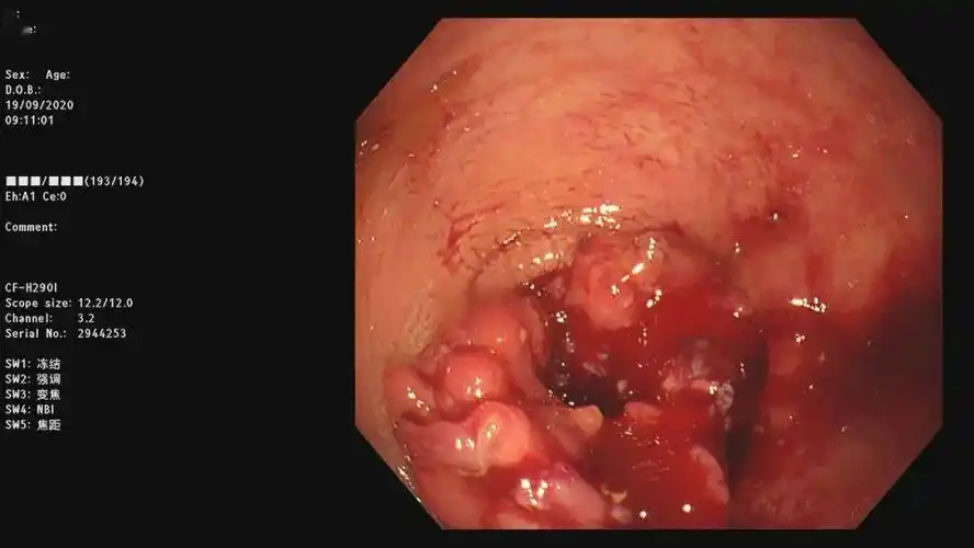 医生说:这些悲剧完全可以避免!