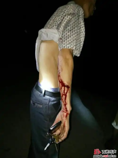 人身安全得不到保障,政府人员却和黑社会势力串通联合起来欺压百姓