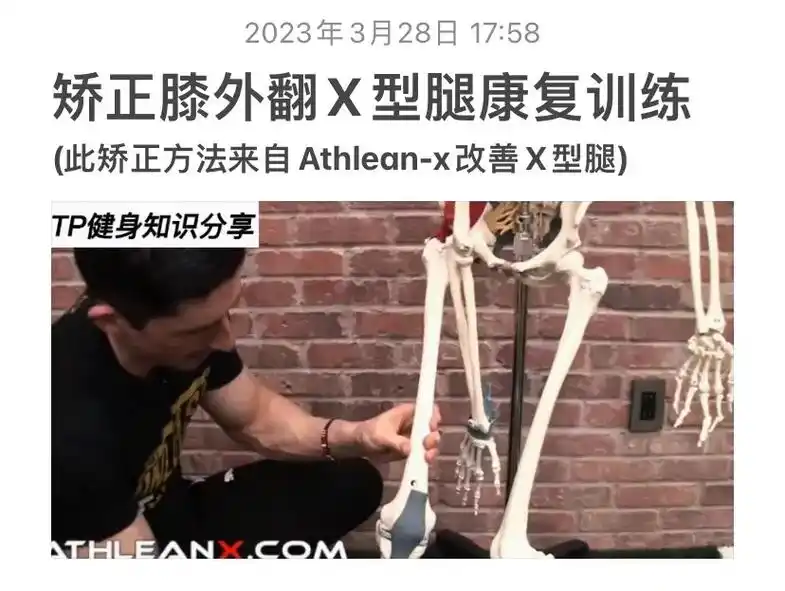 改善不良x型腿康复训练.以上是纠正膝外翻,改善x型腿,每个动 - 抖音