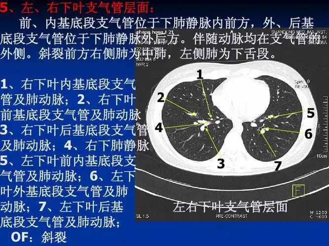 肺,肝的分叶分段ppt