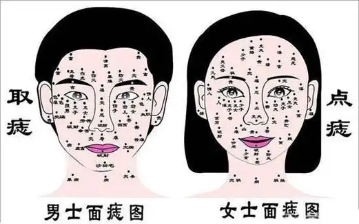 下巴痣:下巴分为三部分,承浆,讼堂,地阁,地