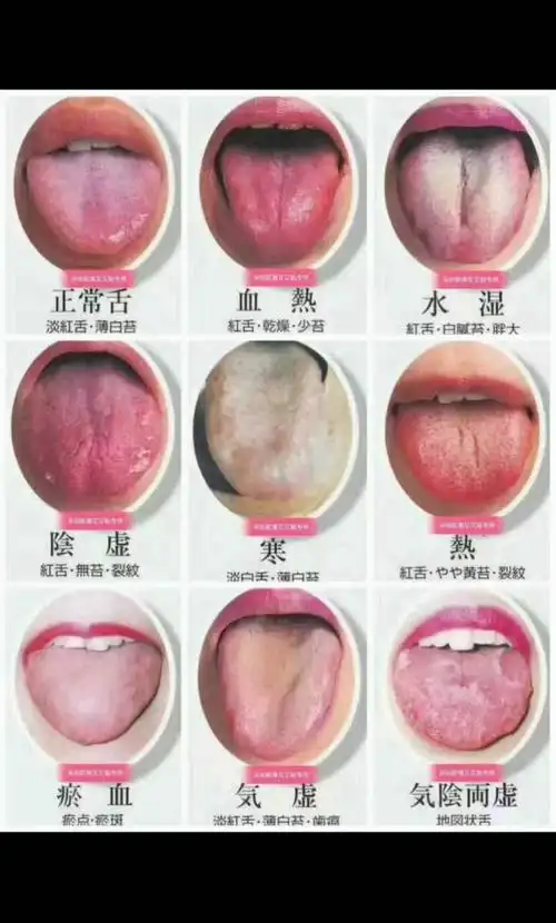 舌苔的秘密,艾艾贴小知识