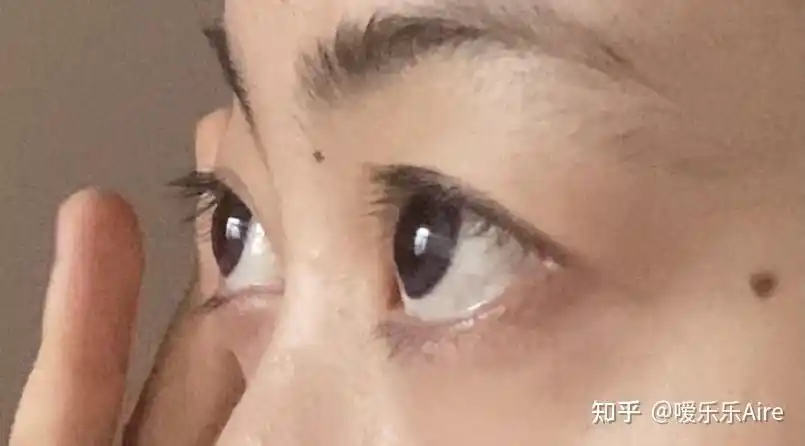 这算眼球突出吗? - 知乎