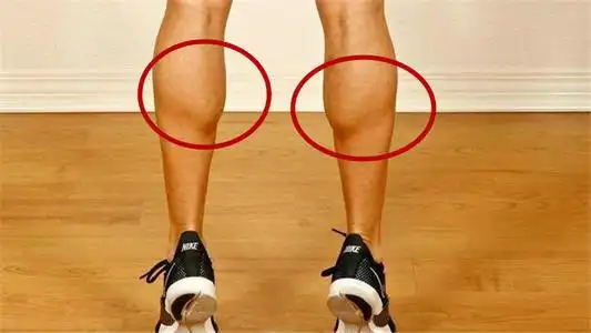 跑步小腿肚变粗了怎么办 跑完步后做什么能不使小腿肌肉变粗