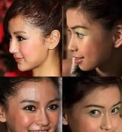 杨颖整容前后照片,baby整容前(杨颖整过容?