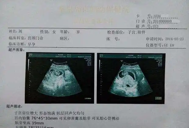 孕囊数据46-52天的比较准,数据不能超过8周,必须是三个数据,如果两个