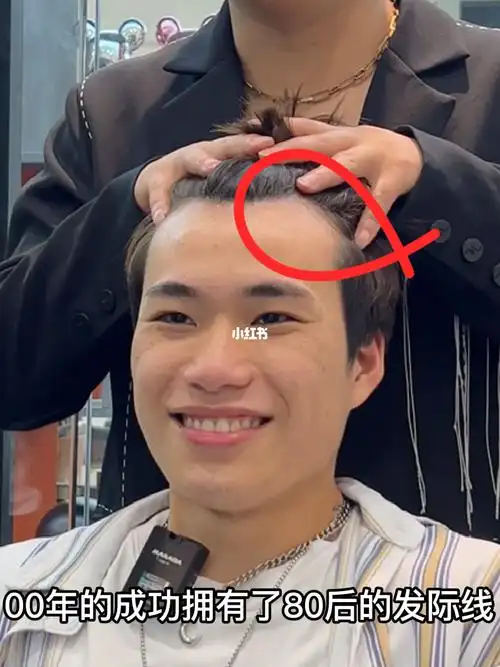 m型发际线男生适合的发型