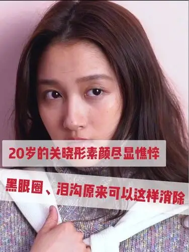 看到关晓彤上热搜竟然是因为"黑眼圈",我真的是要笑晕了.