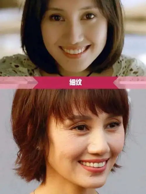 明星衰老照对比,看看迪丽热巴,赵雅芝,袁泉,高圆圆_肌肤