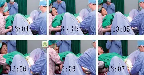 实拍产妇顺产分娩全过程