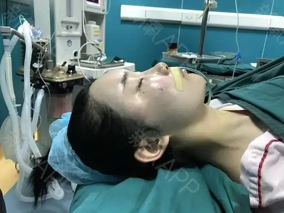 因为我做的是全麻手术嘛,全程都是睡觉状态看不到术后_圈子-新氧美容