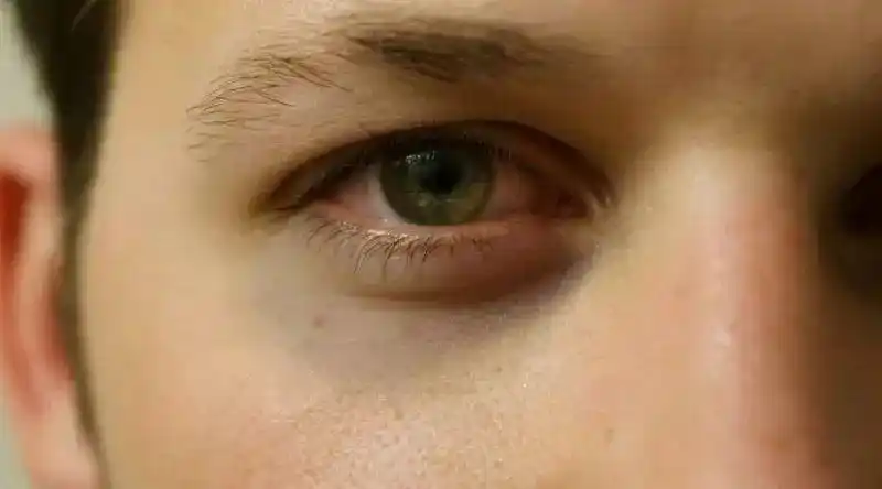 请点击这里._黑眼圈