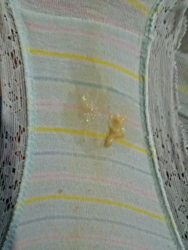 好事多磨!怀孕初期白带症状"经久不息"-第2张图片-西口博客