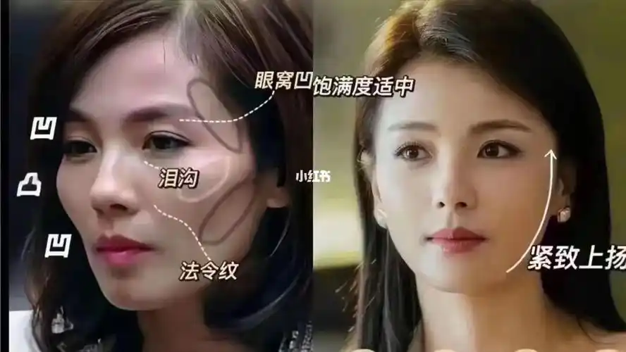 脸可以瘦但不能凹凹了不仅显年龄面相还