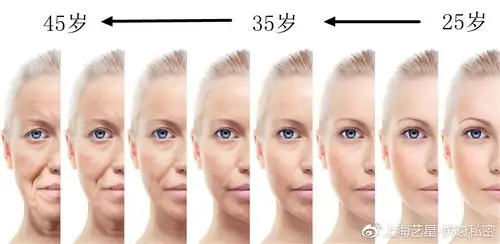 面部衰老过程(从右至左)
