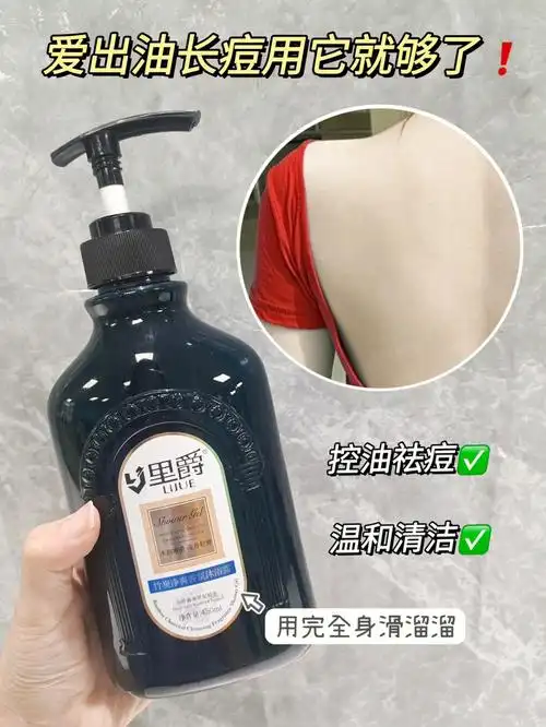 身上爱出油长痘的用它就够了75家人们快冲