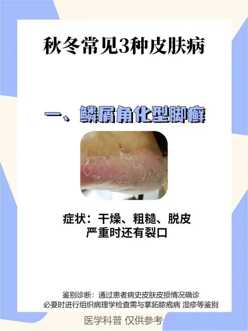 秋冬季高发这3种皮肤病,注意防范.#医学科普 #皮肤问题 # - 抖音