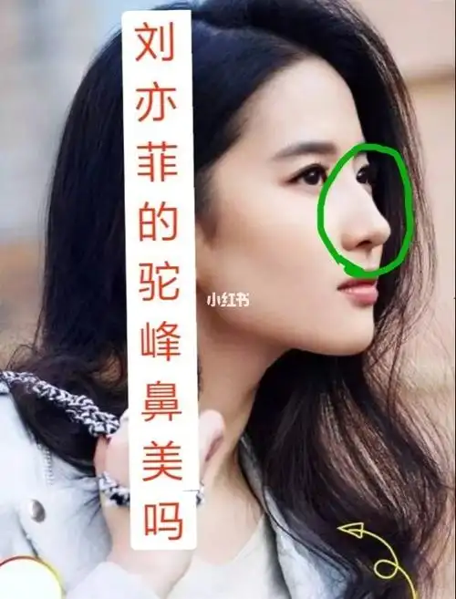 之前都说有驼峰鼻的都好难看.