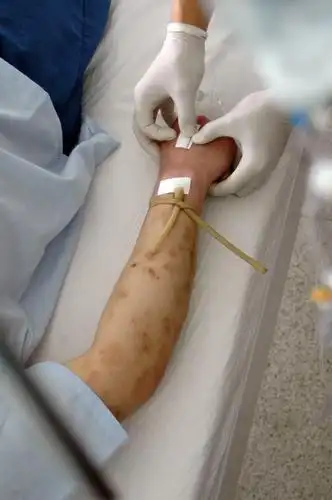 图文戒毒劳教人员的身体长时间注射毒品千疮百孔