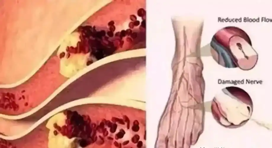 这个动作坐着,躺着都能做,简简单单打通4条经络