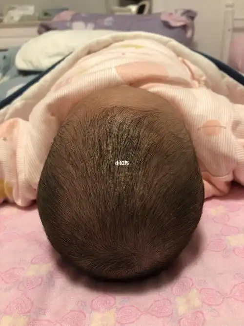 两个多月的宝宝,这个头型怎么调整啊?