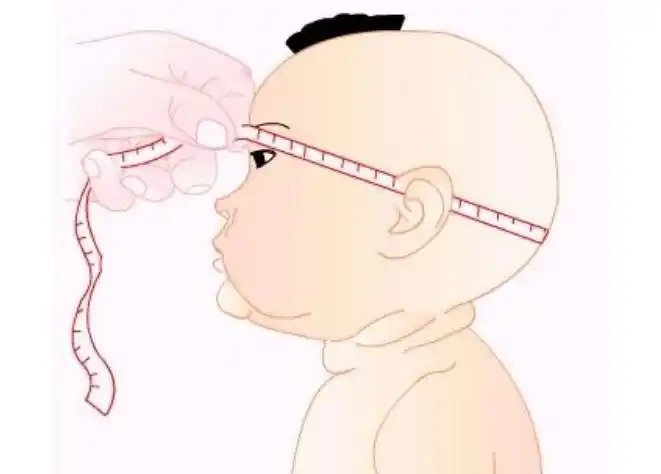 眼睛会表现为"落日征",患儿的眼球会下垂至眼睑的下方,并且眼睛的大