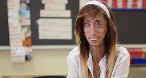 美女子被讽"世界最丑女人" 全身皮包骨头(组图)