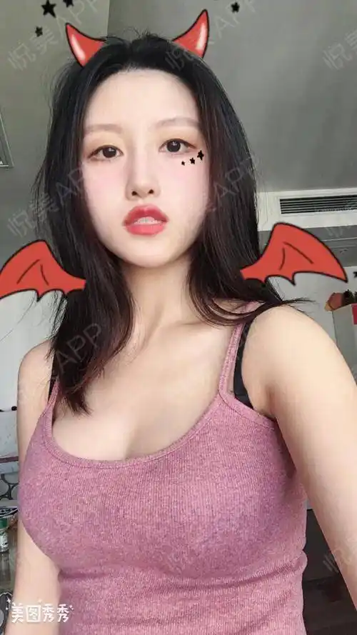 复合隆胸术后50天_假体隆胸术后50天_隆胸术后50天_胸部整形术后50天