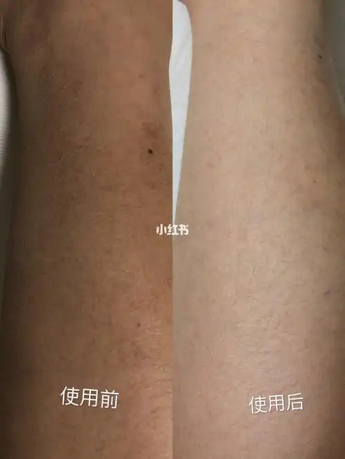 对抗角质鸡皮粗糙皮肤平价又有效的美白身体磨砂膏