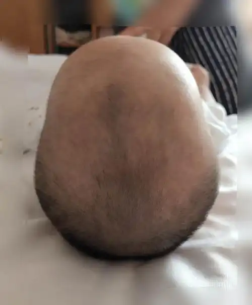 前两个月一直都是侧睡侧头侧身,后来我婆婆每次来都会说娃的后脑勺