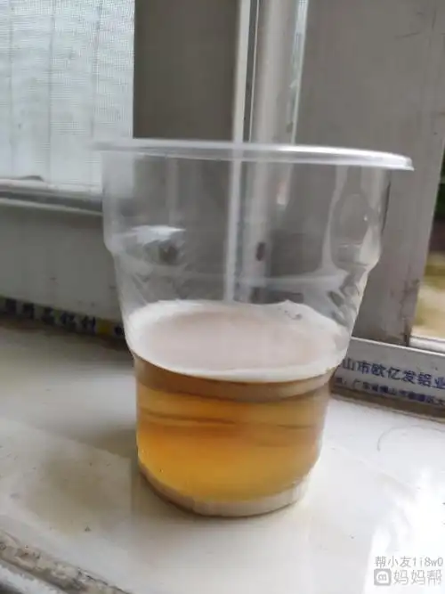 圆肚子女14肚子小男,肚子大女75%酒精测男女图片结果15除了肚体其他