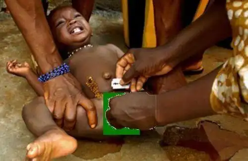 非洲女孩割礼残忍血腥 少女被割去阴蒂阴唇