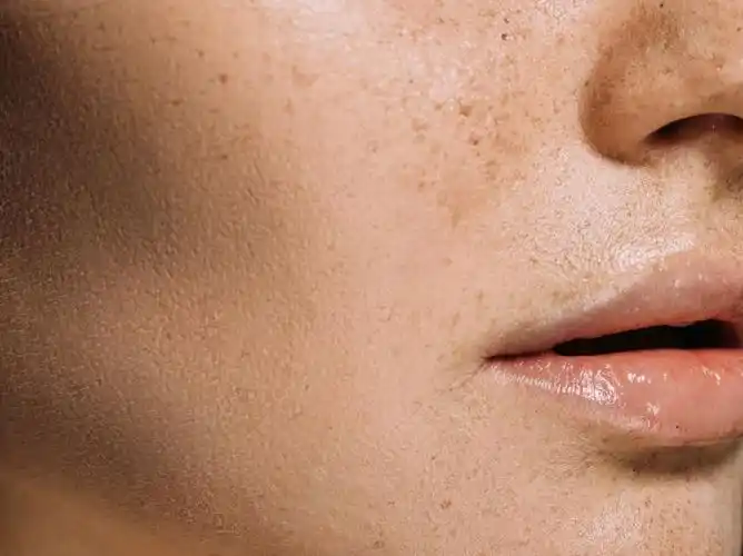 脸色暗黄,没有其它身体不适,做好这4点帮你缓解脸色暗沉