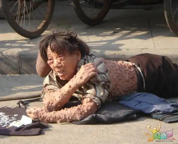 恶心死我了,心理承受能力差的慎入啊,切记!