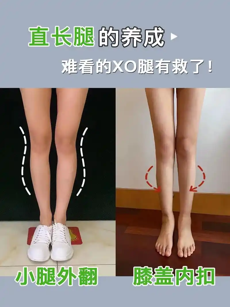 直长腿的养成方法难看哦xo型腿有救了