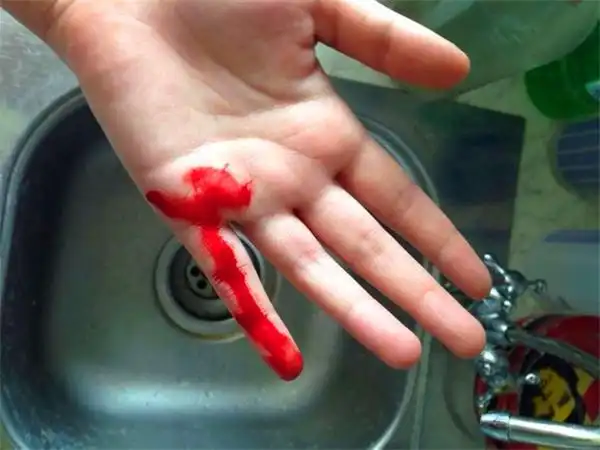 切菜伤到手指引起血压升高老人竟突发脑出血昏迷