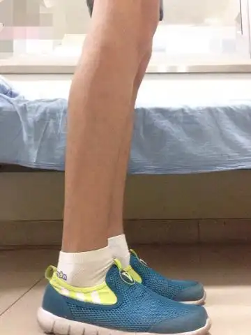 17岁男生这样的腿算细吗?腿毛是不是有点太少了?