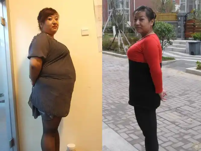 超声法减肥让我成为时尚辣妈