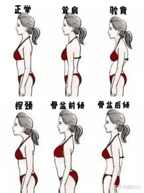 体态的重要性往往很多人都忽略了