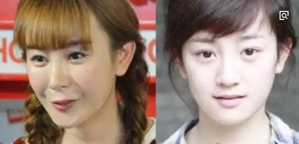 张檬整容前后照片对比好好的一张美人脸被整残判若两人