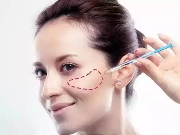 苹果肌到底有什么好?她们都把她当宝!